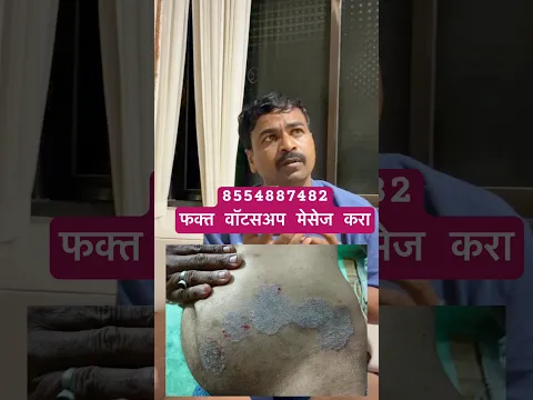 कसलाही खजण्याचा प्रॉब्लम असूद्या