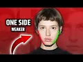 Download Lagu Facial Asymmetry: Why One Side of Your Jaw is Smaller – Real Science \u0026 Fixes