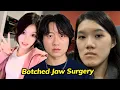Chinese Model Goes Viral After Plastic Surgery