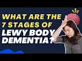 What Are the 7 Stages of Lewy Body Dementia Understanding the Journey