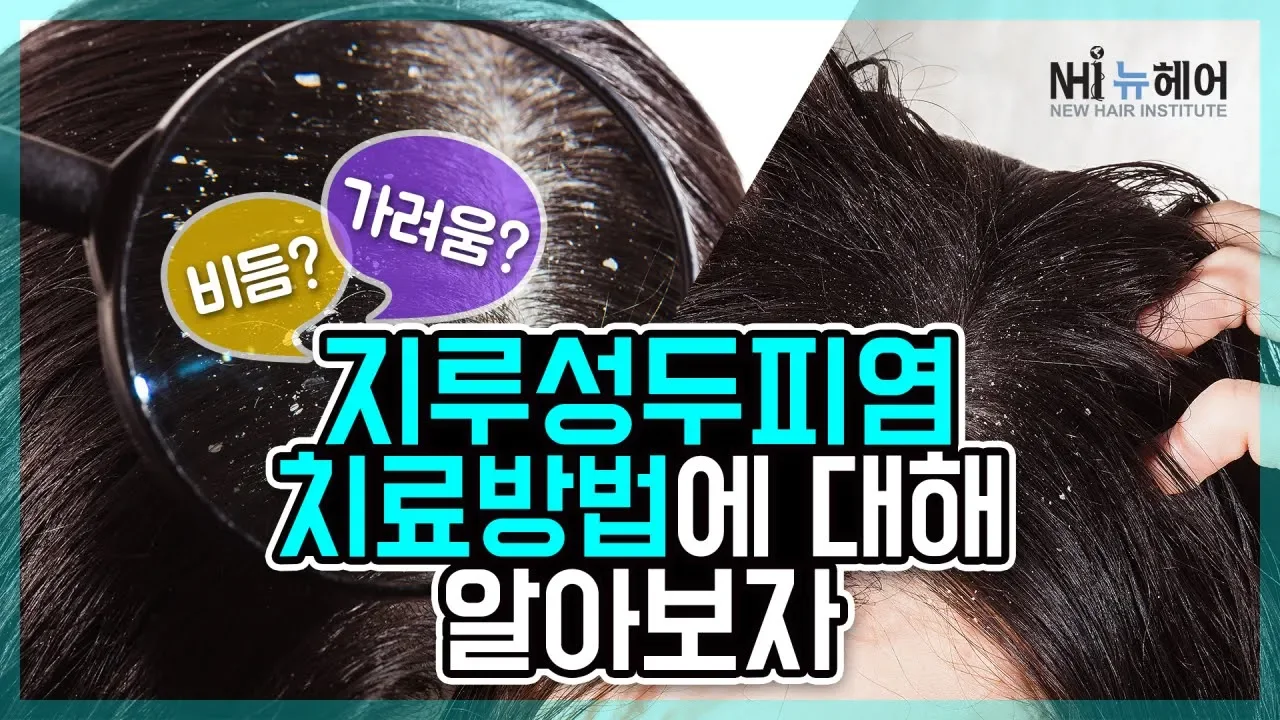 비듬 가려움 지루성 두피염은 어떻게 치료하나요? (김진오원장의 뉴헤어연구소)
