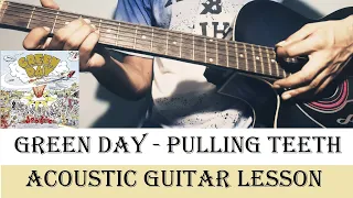 Download Acoustic Guitar Lesson For Beginners (Green Day - Pulling Teeth) MP3
