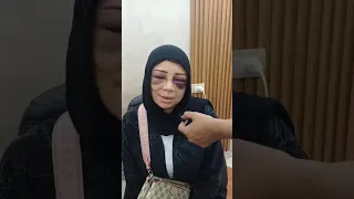 أول ظهور ل  عروسة بورسعيد   خطيبها عمل فيها اللي محدش يتوقعه والسبب صادم    بث مباشر دندنها