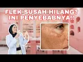 Download Lagu CARA AMPUH HILANGKAN FLEK DI WAJAH!!!!!!! (Ini dia penyebab flek susah hilang)