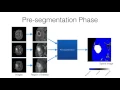 RSNA 2016 ITK-SNAP Training - Automatic Segmentation