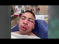 Detention officer speaks out after being attacked by Harris County Jail inmate