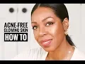 How To Get Acne-Free Glowing Skin A Step-By-Step Process Style Domination by Dominique Baker