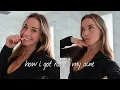 how to actually get rid of acne