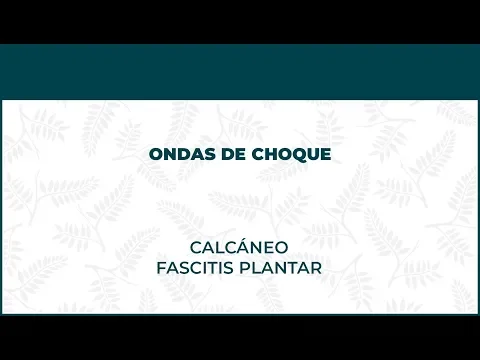 Calcáneo y fascitis plantar. Ondas De Choque - FisioClinics Madrid