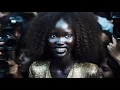 Meet The Rarest Black People In The World