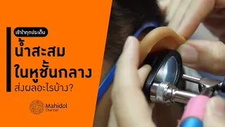 เด็กทั่วไปสามารถมีน้ำในหูชั้นกลางได้ไหม