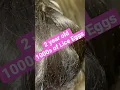 Download Lagu Toddler with 1000s of Lice Eggs l Extreme Lice Infestation l Lice Removal Service