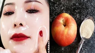 ضعيها في الليل على التصبغات والبقع وفي الصباح سيتفاجئ من يرى وجهك