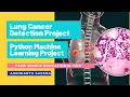Lung Cancer Detection Project Python Machine Learning Project Demonstration