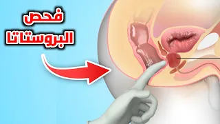 شاهد كيف يتم فحص البروستاتا للرجال Prostate Enlargement And Rectal Examination 