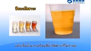 สาเหตุหลักที่ทำให้เกิดมะเร็งกระเพาะปัสสาวะคืออะไร
