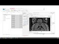 Batch Processing for NIFTI Files without writing a script