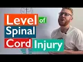 Spinal Cord Injury Levels of injury