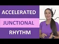 Accelerated Junctional Rhythm ECG Nursing EKG NCLEX Review Made Easy