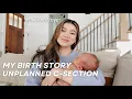 Download Lagu MY BIRTH STORY - Unplanned C-Section (super positive) \u0026 Recovery!