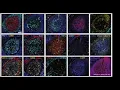 Introduction to the steinbock toolkit for multiplexed tissue image processing