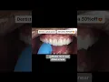 Download Lagu Jamal Dental Clinic #braces #dentist #smiledesigndental #teethwhitening #smile #doctor