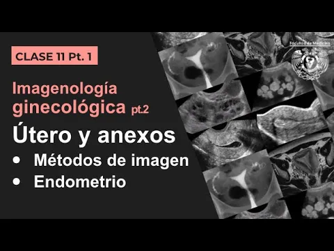 Download MP3 11.1 -  Imagen Ginecológica: Métodos de estudio  y patología endometrial