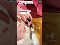 Kinesiology Taping technique for finger sprain Ligament support