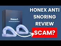 Download Lagu Honex Anti-Snurk Mondstuk Review - Legitiem of Oplichterij?