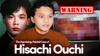 WARNING The Agonizing Painful Case of Hisachi Ouchi Umiiyak na Siya ng Dugo