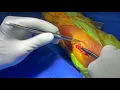 Download Lagu Dr Mustafa Alttahir Repairs Broken Arm