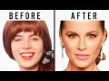 Kate Beckinsale s NEW FACE Plastic Surgery Analysis