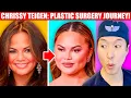 CHRISSY TEIGEN Cosmetic Surgery Transformation