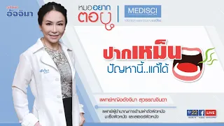 กลิ่นปากเกิดจากสาเหตุอะไรบ้าง ถึงแม้ฟันจะไม่ผุและไม่มีหินปูน