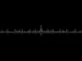 Download Lagu Sleeping At Last - Saturn (1-hour-infini-loop) #infiniloop