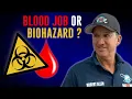 Blood Job or Biohazard For Carpet Cleaners How To Remove Blood Stains From Carpet