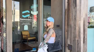 Tattoo Removal Experience VLOG REACTION REMOVERY