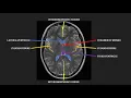 Introduction to MRI of the brain