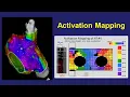 Activation Mapping Basic Concepts Pitfalls and Windowing