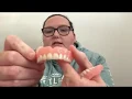 Comparing my temporary dentures Why I went to affordable dentures