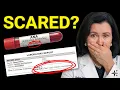 Positive ANA Test Here s What Your Doctor Missed