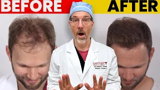 Lifestyle Factors That Can Reverse Hair Loss (Your Doctor Didn't Ask About It)
