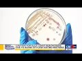 Health s urge caution for Gulf Coast beachgoers during surge of deadly bacterial infections