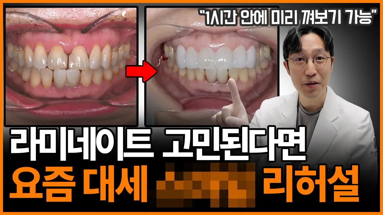 "생각했던 모양이랑 다른데요?" 라미네이트 재시술 막는 법/스마일 리허설