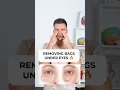 Download Lagu REMOVING UNDER EYE BAGS❤️‍🔥 #undereyedarkcircles #eyebags #undereyebags #eyewrinkles #facefitness