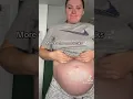 35 weeks pregnant symptoms 1 cm dialated