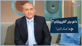 كيفية التخلص من مرض الفايبرومايالجيا مع دكتور حساب الديب جروب الماميز 