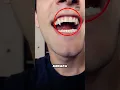 Download Lagu Kenapa ada orang yang memiliki gigi vampir😱