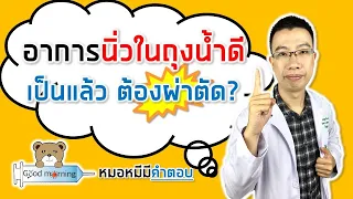 ใครมีความเสี่ยงสูงที่จะเป็นนิ่วในถุงน้ำดี?