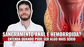 Sangramento Anal é Hemorroida? Entenda Quando Pode Ser Algo Mais Sério